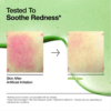 Anua Azelaic Acid 10 Hyaluron Redness Soothing Serum – product image 7