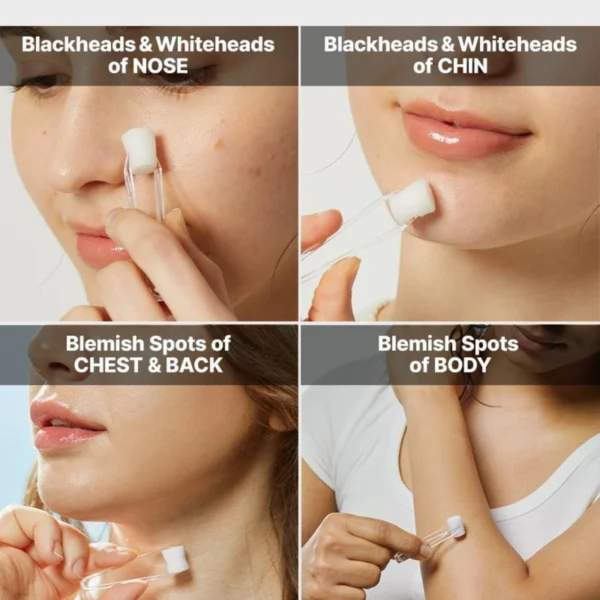 COSRX The AHA 2 BHA 2 Blemish Treatment Serum 50g