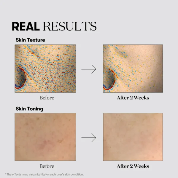 VT Cosmetics Tx-toning Essence 1000 shot