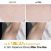 Dr. Melaxin Peel Shot Exfoliating Kojic Acid Turmeric Spray - Körperpeeling Spray 200ml