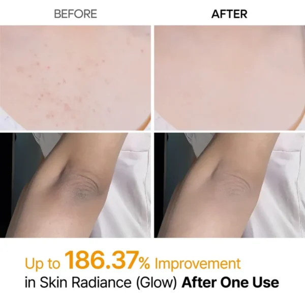 Dr. Melaxin Peel Shot Exfoliating Kojic Acid Turmeric Spray - Körperpeeling Spray 200ml